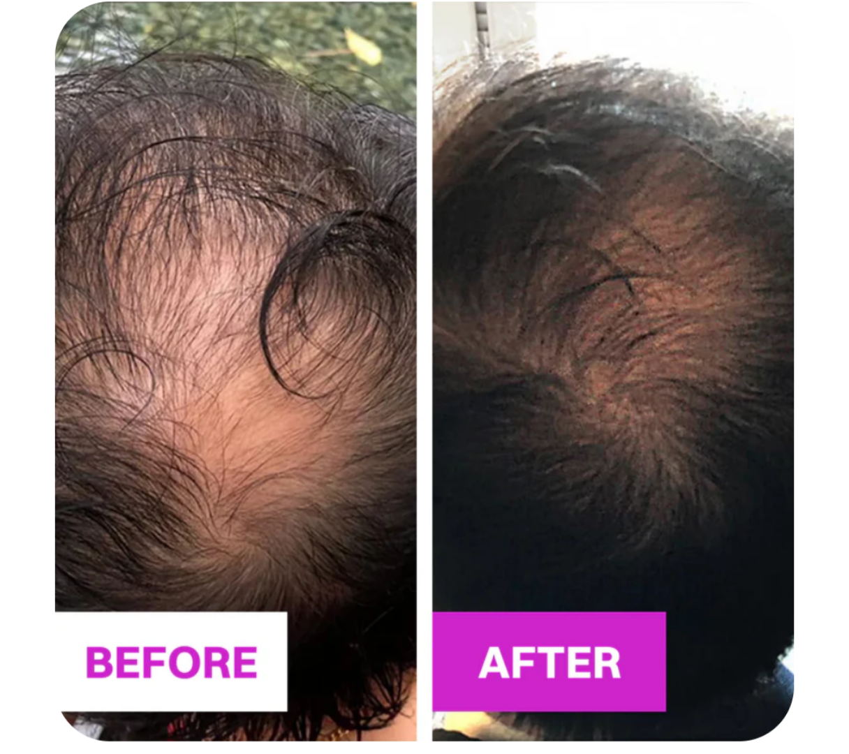 Hair Growth Brush™