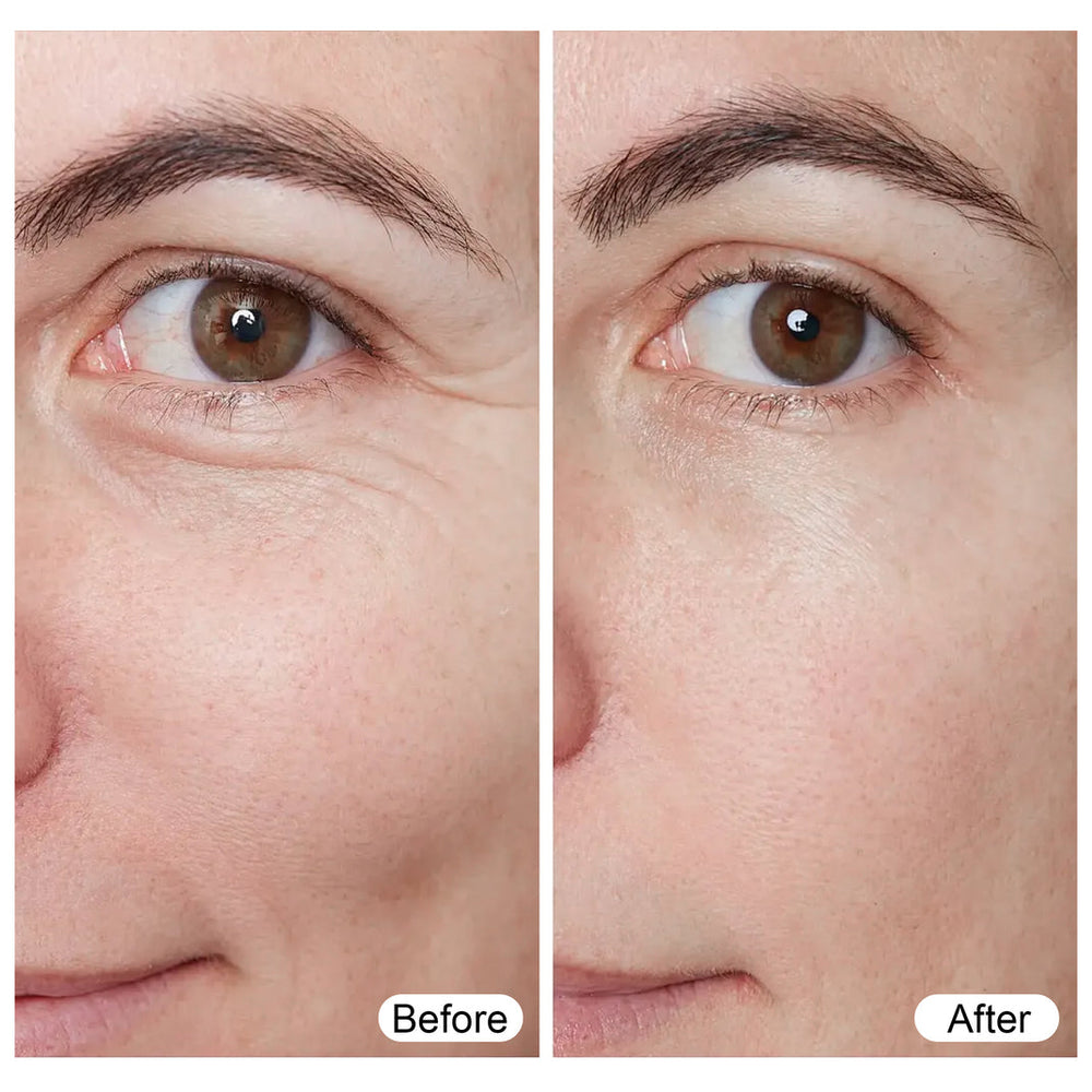 <h2>Over 30,000 women swear by it-Real glow. No makeup Just smooth, radiant skin</h2>