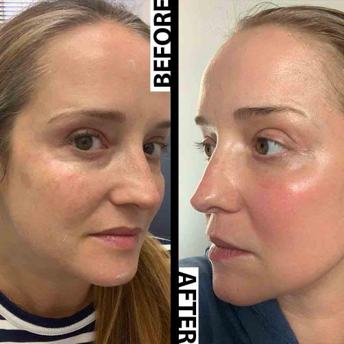 <h2>Over 30,000 women swear by it-Real glow. No makeup Just smooth, radiant skin</h2>