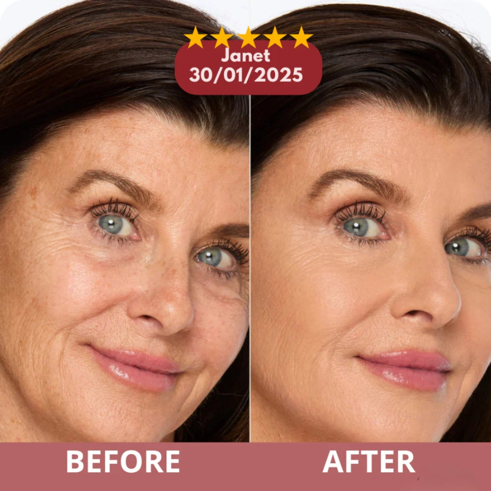 <h2>Over 30,000 women swear by it-Real glow. No makeup Just smooth, radiant skin</h2>