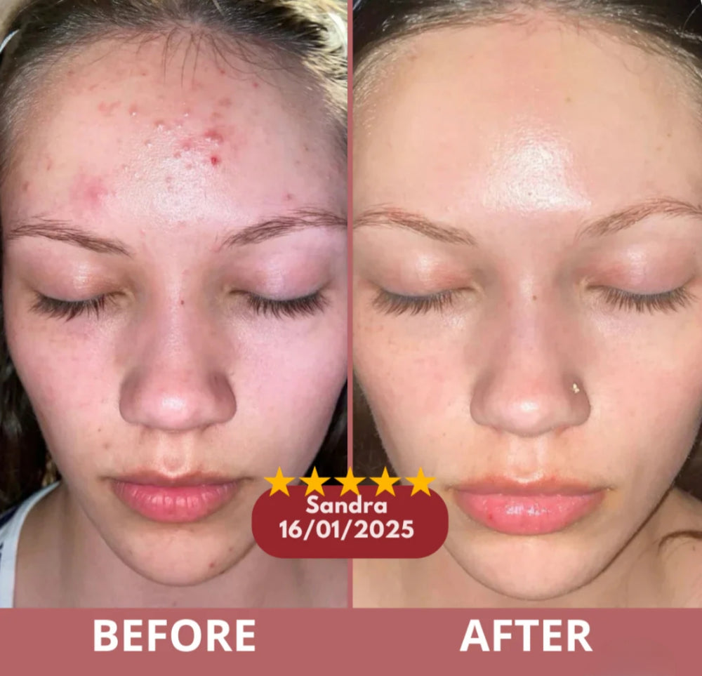 <h2>Over 30,000 women swear by it-Real glow. No makeup Just smooth, radiant skin</h2>