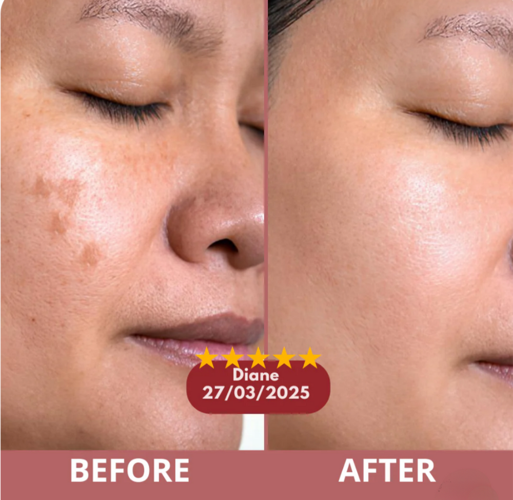 <h2>Over 30,000 women swear by it-Real glow. No makeup Just smooth, radiant skin</h2>