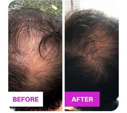 Hair Growth Brush™